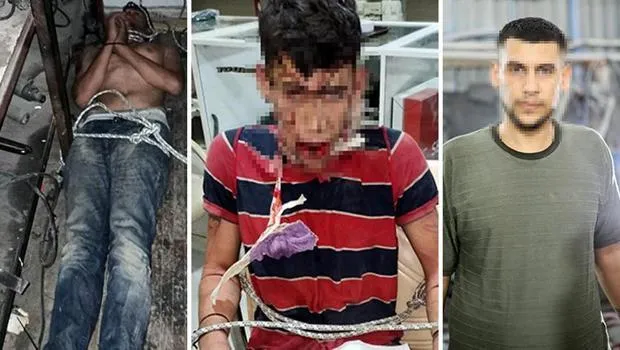 İşkence İddiası Şoke Etti: Adli Tıp Raporu Gerçeği Ortaya Çıkaracak Mı?