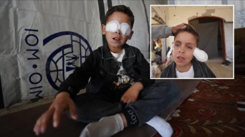 Gazze'de Gözler Karanlığa Gömüldü! 1500 Kişi Görme Yetisini Kaybetti